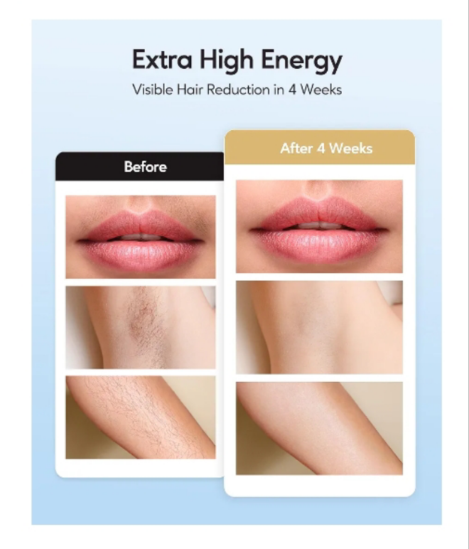 Laser Hair Removal with Ice Cooling Care Function for Women Permanent,999,999 Flashes Painless IPL Hair Remover, Hair Removal Device for Armpits Legs Arms Bikini Line