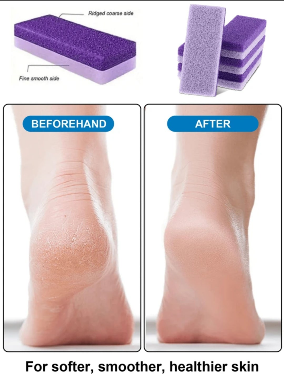 4Pcs Purple Foot Grinding Stone, PU Material Pumice, Sponge Block Pedicure Manicure Scrubber Scrub Tools Callus Exfoliate Feet Heel File Dead Skin Remover, Foot Care, Foot Scrubber, Feet Scrub, Valentine's Day Gifts, New Year Gifts, Travel Essentials