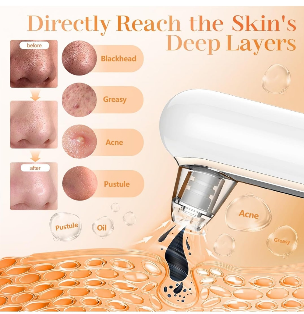 Blackhead Remover Vacuum Pore Extractor Black Head Remover for Face&Nose Blackhead Extractor Pore Vacuum Pimple Extractor Tool Pore Cleaner with USB Charge 4 Modes 5 Suction Heads for Women&Men