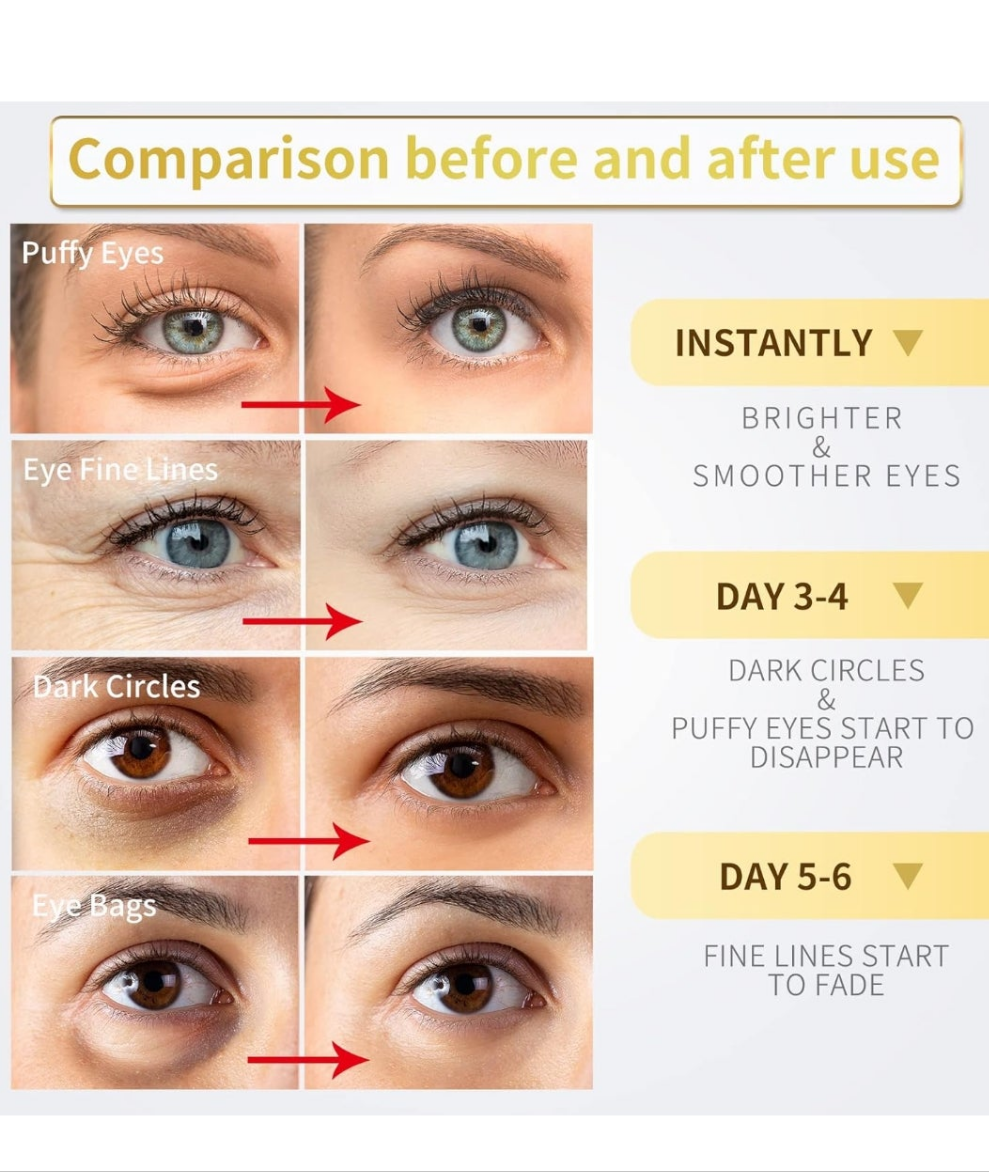 24K Gold Under Eye Patches - 60 Pack for Puffy Eyes, Dark Circles, Bags & Wrinkles with Collagen & Hyaluronic Acid