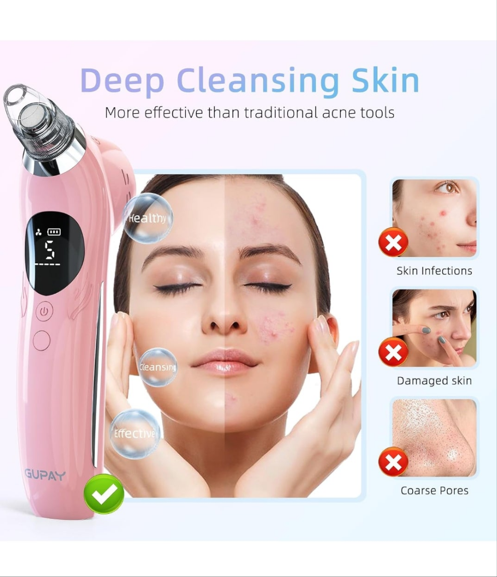 Blackhead Remover Vacuum Facial Pore Cleaner Electric Comedone Whitehead Extractor 5 Suction Probes and 5 Suction Levels Rechargeable Black Heads Remover Tools for Women & Men Facial Skin Care