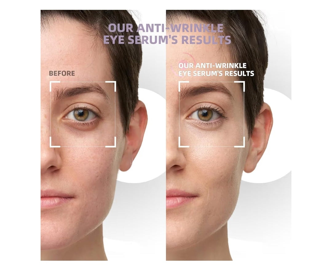 5% Caffeine Eye Cream & Under Eye Serum for Dark Circles and Puffiness, 360° Massage Roller Ball Eyes Treatment Seru