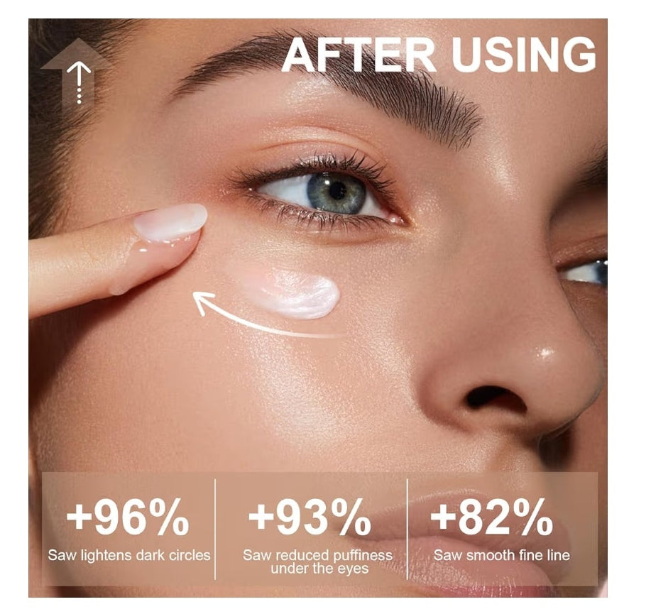 5% Caffeine Eye Cream for Dark Circles Under Treatment Eye Serum for Wrinkles Fine Lines, Retinol Under Cream for Puffiness and Bags with 360° Massage Roller-Ball